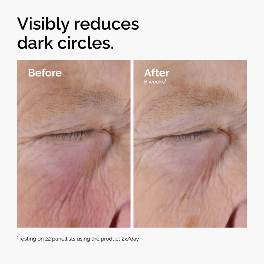 caffeine-solution-5-egcg-eye-serum-z8 ord-caffeine-solution-egcg-dark-circles-before-after.jpg