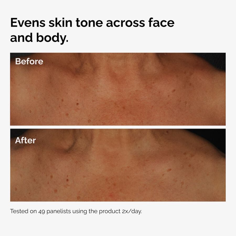 the-body-care-collection-f1 ord-niacinamide-face-body-serum-before-after-even-tone-graphic.jpg